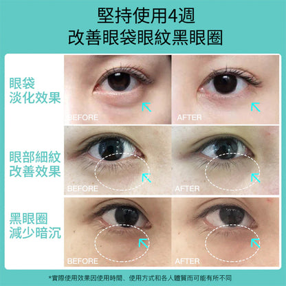 JUJY 紀芝 逆齡多極射頻美眼儀