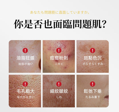 JUJY 紀芝 逆齡煥膚美光機