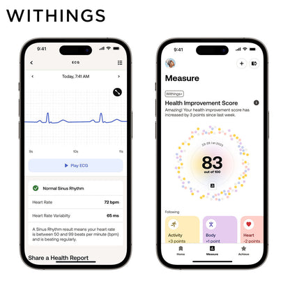 WITHINGS ScanWatch Light 混合智慧型手錶【兩年保養】